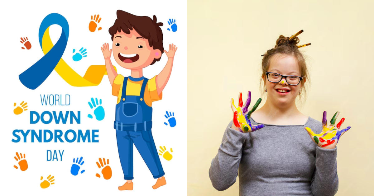 obilježavanje Svjetskog dana osoba sa Downovim sindromom